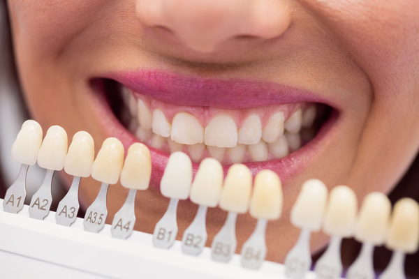Tooths-65412-magnific
